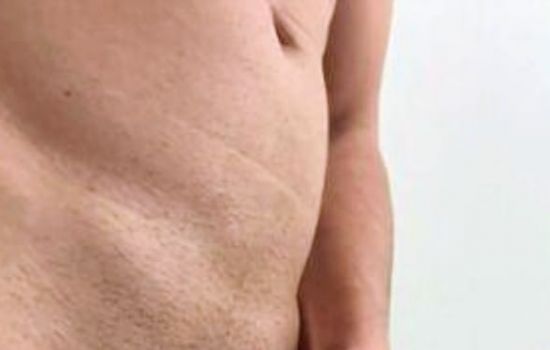 Mathias Uy Masajista masculino