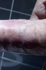 Photo #11 of Apolo Ginger