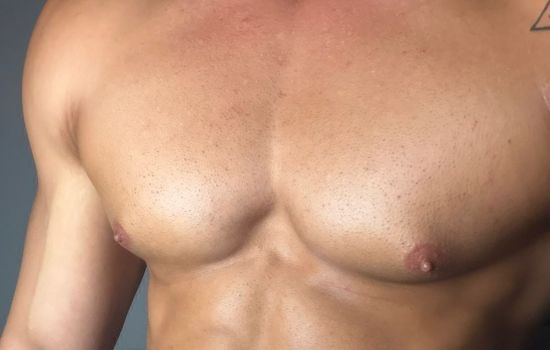 Nacho Fit Masajista masculino