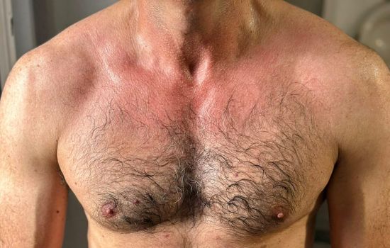 El Profesional Escort Masculino