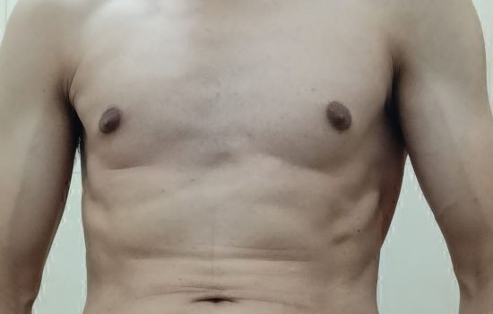 Fran 86 Male Escort