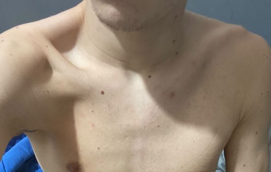 Agussino Escort Masculino