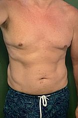 Foto #3 de Pela Masajes